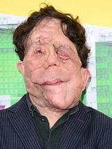 foto de Adam Pearson