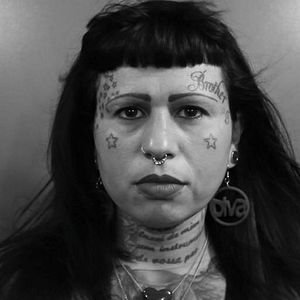 Foto Cicatriz Que Me Define