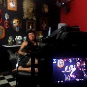 Foto Cicatriz Que Me Define