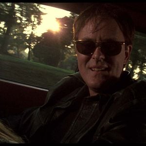 Foto Síndrome de Caim