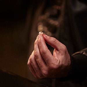 Foto Dente por Dente