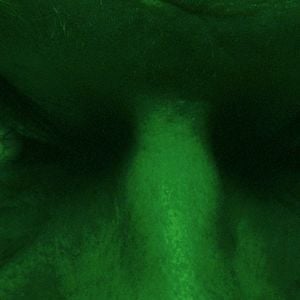 Foto O Estranho Colorido das Lágrimas do teu Corpo