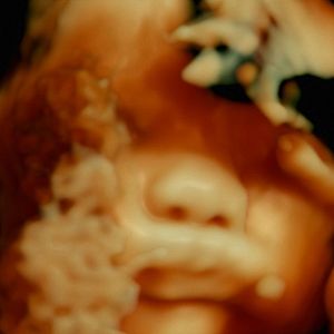 Foto De Humani Corporis Fabrica