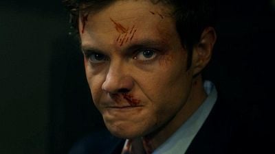 Imagem da notícia Novocaine: Herói interpretado por Jack Quaid não sente dor; isso acontece na vida real?
