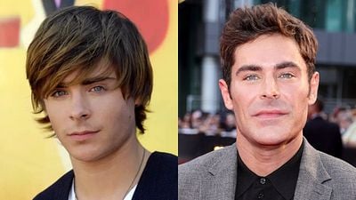 Imagem da notícia O que realmente aconteceu com o rosto de Zac Efron? Ator relembra acidente grave e boatos de cirurgia plástica