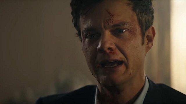 Imagem da notícia Novocaine: Jack Quaid aparece machucado em jogo de basquete – mas existe uma boa explicação