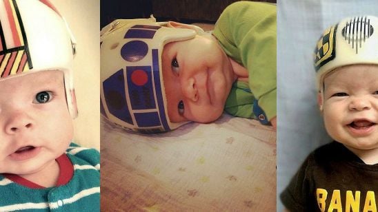 Imagem da notícia Pai decora capacete corretivo do filho com personagens de Star Wars